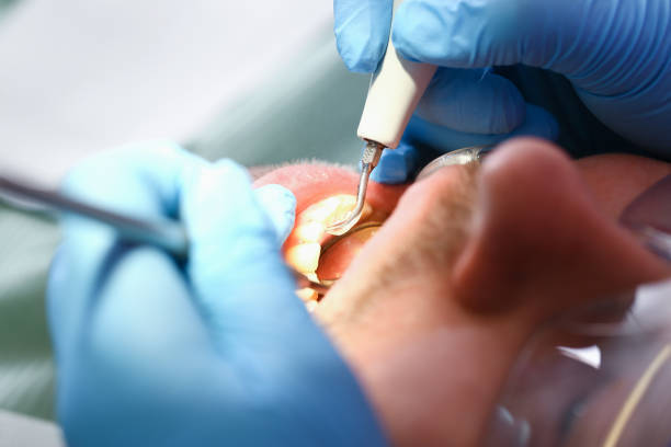 Best Urgent Care for Lost Fillings or Crowns in Palos Heights, IL